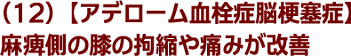 (12)【アデローム血栓症脳梗塞症】麻痺側の膝の拘縮や痛みが改善